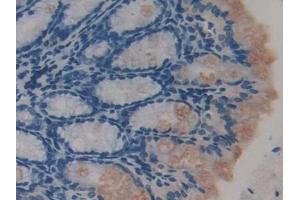 Detection of TTK in Mouse Colon Tissue using Polyclonal Antibody to TTK Protein Kinase (TTK)
