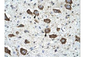 Image no. 1 for anti-Kv Channel Interacting Protein 2 (KCNIP2) (AA 22-71) antibody (ABIN6735459)