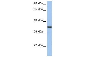 HORMAD2 antibody used at 1 ug/ml to detect target protein. (HORMAD2 anticorps  (N-Term))