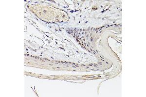 Immunohistochemistry of paraffin-embedded Mouse skin using Pea3 / ETV4 antibody (ABIN6131217, ABIN6140332, ABIN6140334 and ABIN6221480) at dilution of 1:100 (40x lens).