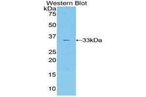 Western blot analysis of the recombinant protein. (IL20RA anticorps  (AA 268-538))