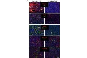 CXCL1 function in ASCs αSMA expression and endothelium stimulation. (CXCR1 anticorps  (C-Term))