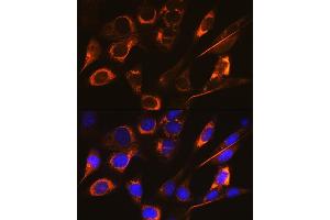 Immunofluorescence analysis of NIH-3T3 cells using SFRP4 Rabbit mAb (ABIN7270180) at dilution of 1:100 (40x lens).