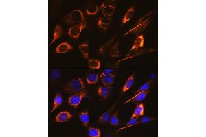 Immunofluorescence analysis of NIH-3T3 cells using SFRP4 Rabbit mAb (ABIN7270180) at dilution of 1:100 (40x lens). (SFRP4 anticorps)
