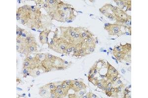 Immunohistochemistry of paraffin-embedded Human stomach using FGF13 Polyclonal Antibody at dilution of 1:100 (40x lens). (FGF13 anticorps)