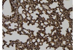 ABIN6273268 at 1/100 staining Mouse lung tissue by IHC-P.