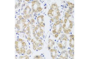 Immunohistochemistry of paraffin-embedded human stomach using MIP antibody (ABIN5971491) at dilution of 1/100 (40x lens). (MIP anticorps)