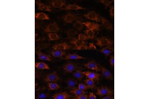 Immunofluorescence analysis of C6 cells using HEBP2 antibody (ABIN7267604) at dilution of 1:100.