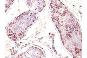 Formalin-fixed, paraffin-embedded human Testis stained with MAGE-1 Monoclonal Antibody (SPM282). (MAGEA1 anticorps)