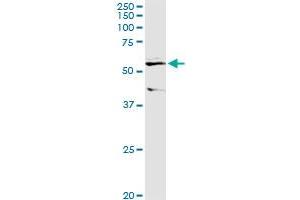 ALDH3B1 MaxPab rabbit polyclonal antibody.