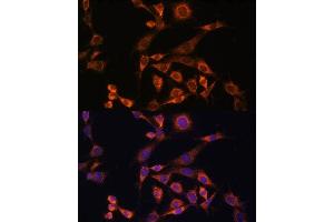 Immunofluorescence analysis of NIH/3T3 cells using MEK2 antibody (ABIN7268640) at dilution of 1:100.