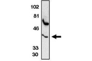 Image no. 1 for anti-Chemokine (C-C Motif) Receptor 5 (CCR5) (AA 6-20) antibody (ABIN265000) (CCR5 anticorps  (AA 6-20))