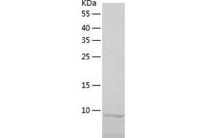Western Blotting (WB) image for Chemokine (C-C Motif) Ligand 28 (CCL28) (AA 20-127) protein (His-IF2DI Tag) (ABIN7122295)
