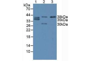 Western blot analysis of (1) Human SW480 Cells, (2) Porcine Large Intestine Tissue and (3) Porcine Small Intestine Tissue. (CDX2 anticorps  (AA 1-313))