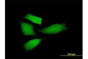 Immunofluorescence of purified MaxPab antibody to AMIGO2 on HeLa cell.