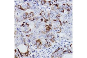 Immunohistochemistry of paraffin-embedded human colon carcinoma using [KO Validated] Cyclin B1 Rabbit mAb (ABIN7266553) at dilution of 1:100 (40x lens). (Cyclin B1 anticorps)