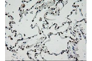 Image no. 2 for anti-Zinc Finger and SCAN Domain Containing 18 (ZSCAN18) antibody (ABIN1501857) (ZSCAN18 anticorps)