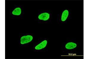 anti-serum/glucocorticoid Regulated Kinase 1 (SGK1) (AA 1-90) antibody