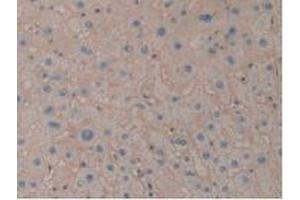 IHC-P analysis of Human Liver Tissue, with DAB staining. (ENPEP anticorps  (AA 718-948))