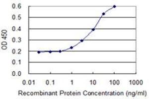 Detection limit for recombinant GST tagged HSD17B7 is 0.