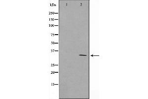 Western blot analysis on COLO205 cell lysate using RNF144A Antibody，The lane on the left is treated with the antigen-specific peptide. (RNF144A anticorps  (Internal Region))