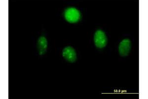 Immunofluorescence of  purified  MaxPab antibody to MYST2 on HeLa cell. (MYST2 anticorps  (AA 1-611))