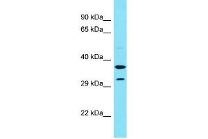 Host: Rabbit Target Name: CENPVP1 Sample Type: Fetal Liver lysates Antibody Dilution: 1. (CENPVP1 anticorps  (C-Term))