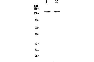 Western blot analysis of CD11c using anti-CD11c antibody .