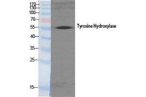 Western Blot (WB) analysis of specific cells using TH Polyclonal Antibody. (TH anticorps  (Tyr161))
