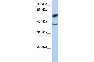SPOPL antibody used at 5 ug/ml to detect target protein. (SPOPL anticorps  (N-Term))