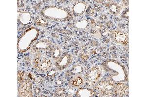 ABIN6266800 at 1/100 staining human kidney tissue sections by IHC-P.