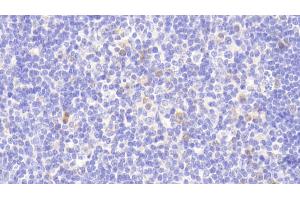 Detection of PARP4 in Human Lymph node Tissue using Polyclonal Antibody to Poly ADP Ribose Polymerase 4 (PARP4)