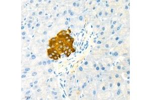 Immunohistochemistry of paraffin embedded mouse pancreatic using MADCAM1 (ABIN7074695) at dilution of 1:1700 (400x lens) (MADCAM1 anticorps)