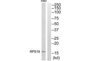 Western Blotting (WB) image for anti-Ribosomal Protein S19 (RPS19) (Internal Region) antibody (ABIN1850576) (RPS19 anticorps  (Internal Region))