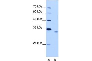 WB Suggested Anti-RBM4B Antibody Titration:  2. (RBM4B anticorps  (C-Term))