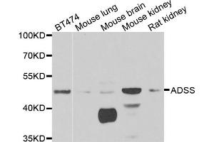 Western blot analysis of extracts of various cell lines, using ADSS antibody (ABIN5973901) at 1/1000 dilution.