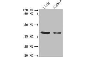 Western blot All lanes: FCGRT antibody at 5. (FcRn anticorps  (AA 24-297))