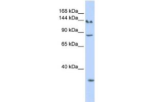 WB Suggested Anti-SIN3A Antibody Titration:  0. (SIN3A anticorps  (N-Term))