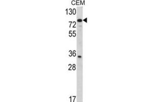 Western Blotting (WB) image for anti-Transglutaminase 4 (Prostate) (TGM4) antibody (ABIN3002879)