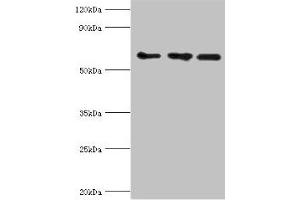 Western blot All lanes: ABCE1 antibody at 4 μg/mL Lane 1: 293T whole cell lysate Lane 2: Hela whole cell lysate Lane 3: k562 whole cell lysate Secondary Goat polyclonal to rabbit IgG at 1/10000 dilution Predicted band size: 67 kDa Observed band size: 67 kDa