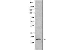 Western blot analysis of MRLC2 using COLO205 whole cell lysates (MYL12B anticorps)