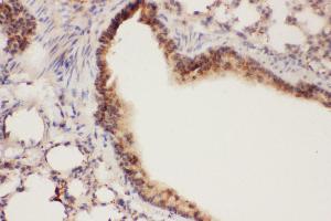 Anti-ALOX15 Picoband antibody,  IHC(P): Mouse Lung Tissue