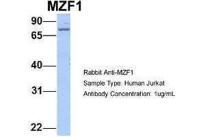 Host: Rabbit Target Name: MZF1 Sample Type: Jurkat Antibody Dilution: 1. (MZF1 anticorps  (N-Term))