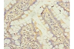 Immunohistochemistry of paraffin-embedded human small intestine tissue using ABIN7157240 at dilution of 1:100