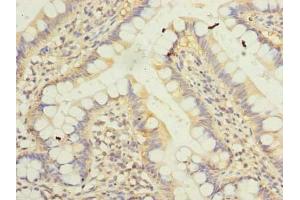 Immunohistochemistry of paraffin-embedded human small intestine tissue using ABIN7157240 at dilution of 1:100 (KLHDC8A anticorps  (AA 1-350))