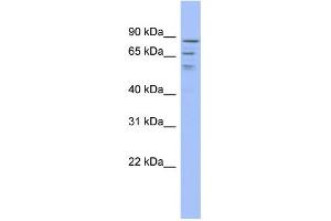 WB Suggested Anti-C1orf25 Antibody Titration:  0. (TRMT1L anticorps  (Middle Region))