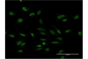 Immunofluorescence of monoclonal antibody to PMS2 on HeLa cell. (PMS2 anticorps  (AA 763-862))