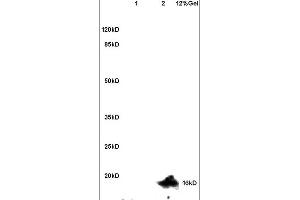 Lane 1: mouse brain lysates Lane 2: mouse heart lysates probed with Anti Ubiquityl Histone H2A.