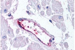 anti-Hormonally Up-Regulated Neu-Associated Kinase (HUNK) (C-Term) antibody
