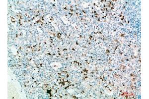 Immunohistochemical analysis of paraffin-embedded human-spleen, antibody was diluted at 1:200